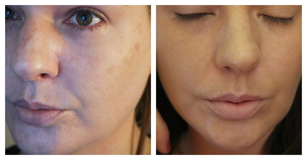 NARS Light Reflecting Foundation Before and After I DreaminLace.com #makeupaddict #beautyblog