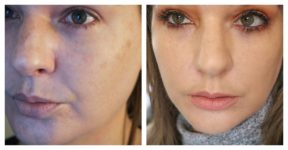 Patrick Starrr BBB Foundation Before and After I DreaminLace.com #makeupaddict #beautyblogå